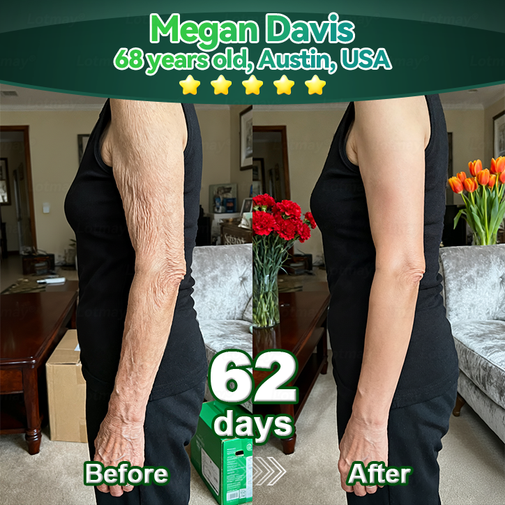 𝐎𝐟𝐟𝐢𝐳𝐢𝐞𝐥𝐥𝐞 𝐄𝐱𝐤𝐥𝐮𝐬𝐢𝐯𝐞 𝐀𝐮𝐟𝐥𝐚𝐠𝐞✅𝑇𝑟𝑖𝑙𝑢𝑚𝑖𝑎® 𝐾𝑜𝑙𝑙𝑎𝑔𝑒𝑛-𝑆𝑡𝑎𝑚𝑚𝑧𝑒𝑙𝑙-𝑉𝑒𝑟𝑗ü𝑛𝑔𝑢𝑛𝑔𝑠𝑠𝑒𝑟𝑢𝑚(𝐒𝐭𝐫𝐚𝐟𝐟𝐞𝐧 & 𝐅𝐚𝐥𝐭𝐞𝐧 𝐫𝐞𝐝𝐮𝐳𝐢𝐞𝐫𝐞𝐧🐦‍🔥